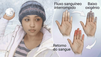 menina segurando uma bola de neve e no detalhe dedos das mãos congeladas 