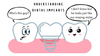 Dental Implants