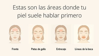 Siluetas faciales que muestran las primeras zonas con signos de envejecimiento donde se aplica bótox preventivo