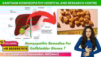 Homeopathy treatment for gallstones in Chennai