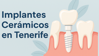 Implantes Cerámicos Tenerife