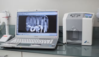 imagem de radiografia na tela do computador com scanner de radiografias ao lado