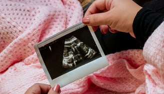 a woman holding a baby's ultrasound scan