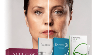radiesee, bioestimuladores