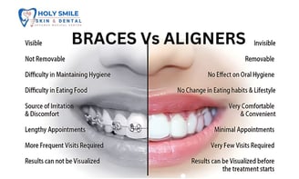 Braces vs aligners which on is best kolkata