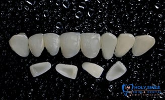 veneer cost in kolkata