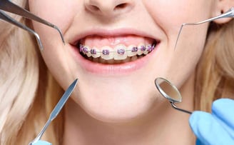 Best Orthodontists in Wadgaon Sheri Pune