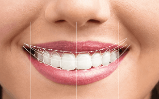 Dental Smile Design Treatment in Wadgaon sheri 