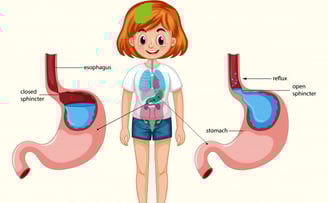 gerd and chest pain