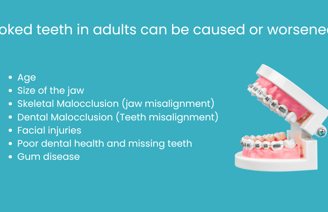 crooked teeth in adults - understanding your options