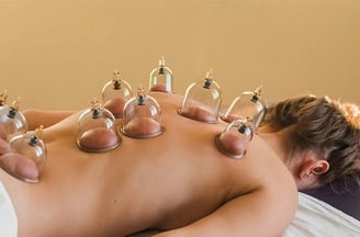 Cupping at Mowbray Marketplace