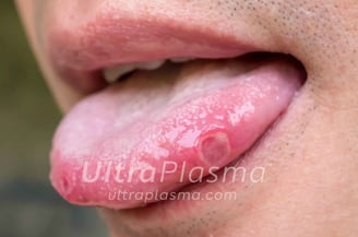 _ultra_plasma_ultra_plazma_ultra-plasma_ultra-plazma