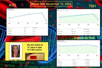 Diabetes improved