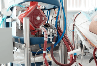 ECMO