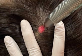 cabinet perma medical : laser
