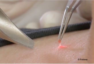 cabinet perma médical : dermatologie