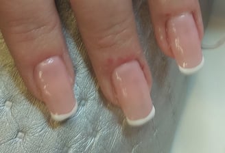 Behandling med tippar & Fransk