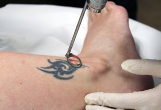 a person with a tattoo on their arm