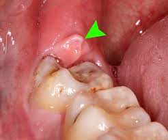 expert in oral surgery