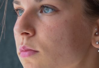 piercing e furo de orelha humanizado