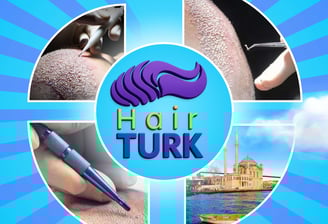 HairTurk hair transplant clinic in Istanbul, Turkey: Procedure tools, scalp, medical tourism.
