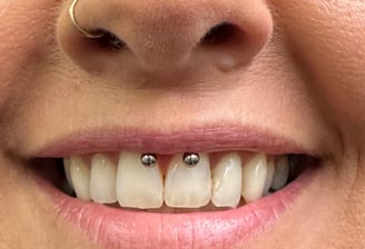 Smiley piercing