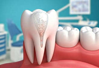 Invisible Fillings in Dentistry kool smiles