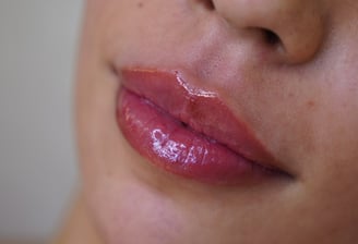 preenchimento labial