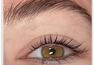 Lminazione Ciglia e Laminazione Sopracchiglia.