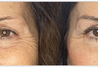 Trucco semipermanente sopracciglia Pelo realistioco. Confronto prima e dopo.