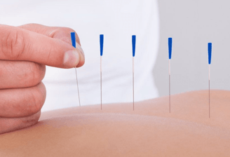 Dr. Leonardo Campos - Acupuntura em Salvador