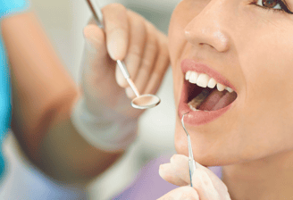 Dentist applying a tooth filling to restore a decayed tooth, showcasing a restorative dental procedu
