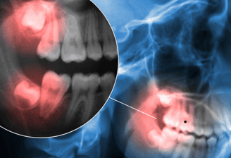 Dentist providing urgent treatment to a patient experiencing severe tooth pain in a dental clinic