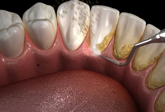 Dental professional performing a gum health evaluation as part of comprehensive periodontal services