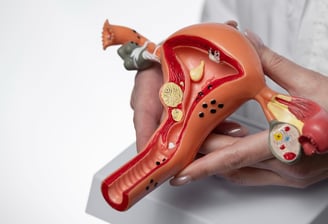 Uterine Cancer