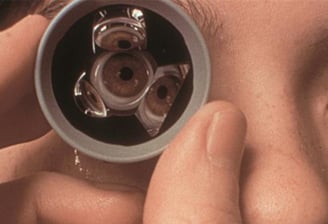 Foto mostrando a lente de 3 espelhos utilizada para realizar o exame de gonioscopia - São Paulo