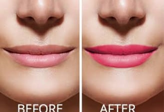 Skindent's Rejuvenate Lip Micropigmentation Services