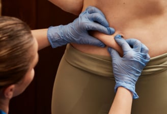 grasa localizada como eliminar