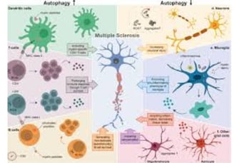 multiple sclerosis and fasting autophagy