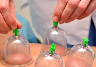 cupping-therapy treatment near Kalaburagi, Karnataka,