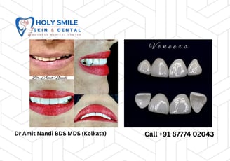 veneer for better smile by Dr Amit Nandi n Jora Girja Kolkata