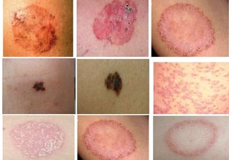 skin diseases treatment Unani clinic near Kalaburagi, Karnataka, Dr Hidayath khan