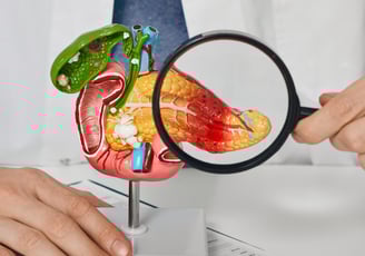 Pancreas Cancer treatment ahmedabad