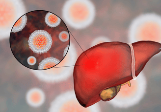 Hepatitis B Hepatitis C Ahmedabad treatment