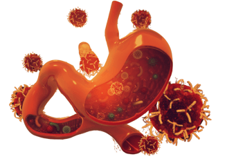 Stomach Cancer treatment in ahmedabad