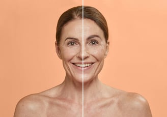 combinal eyebrow lifting