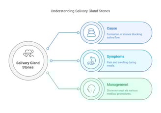 salivary galnd stones
