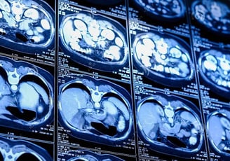 Sequência de imagens de uma tomografia de abdome usadas para fornecer um laudo diagnóstico