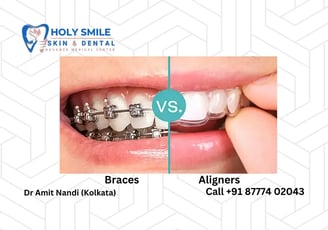 aligner & braces kolkata