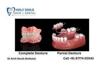 complete denture kolkata